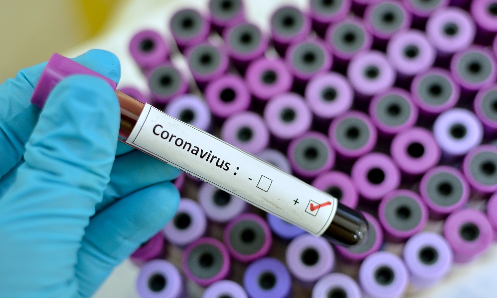 Portugalia coronavirus obecny stan 2020 informacje przewodnik